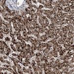 EHHADH Antibody in Immunohistochemistry (Paraffin) (IHC (P))