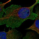 NHE3 Antibody in Immunocytochemistry (ICC/IF)