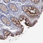 NHE3 Antibody in Immunohistochemistry (Paraffin) (IHC (P))