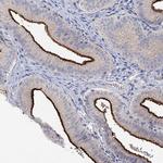 NHE3 Antibody in Immunohistochemistry (Paraffin) (IHC (P))