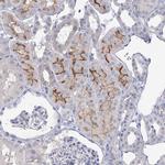 NHE3 Antibody in Immunohistochemistry (Paraffin) (IHC (P))