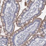 NHE3 Antibody in Immunohistochemistry (Paraffin) (IHC (P))