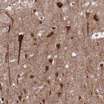 HOMER1 Antibody in Immunohistochemistry (Paraffin) (IHC (P))