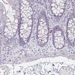 HOMER1 Antibody in Immunohistochemistry (Paraffin) (IHC (P))