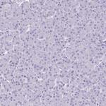 HOMER1 Antibody in Immunohistochemistry (Paraffin) (IHC (P))