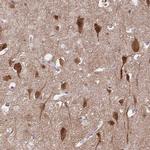 HOMER1 Antibody in Immunohistochemistry (Paraffin) (IHC (P))