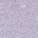 HOMER1 Antibody in Immunohistochemistry (Paraffin) (IHC (P))