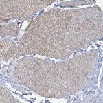 CUEDC2 Antibody in Immunohistochemistry (Paraffin) (IHC (P))