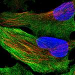 Acetyl-CoA Carboxylase Antibody in Immunocytochemistry (ICC/IF)