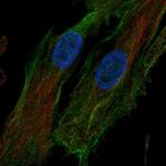 HTRA1 Antibody in Immunocytochemistry (ICC/IF)