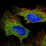 PLCG1 Antibody in Immunocytochemistry (ICC/IF)