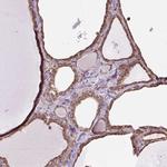 PLCG1 Antibody in Immunohistochemistry (Paraffin) (IHC (P))