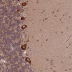 PLCG1 Antibody in Immunohistochemistry (Paraffin) (IHC (P))