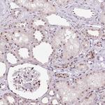 Nucleostemin Antibody in Immunohistochemistry (Paraffin) (IHC (P))