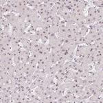 Nucleostemin Antibody in Immunohistochemistry (Paraffin) (IHC (P))