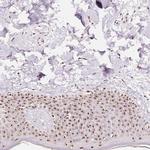 Nucleostemin Antibody in Immunohistochemistry (Paraffin) (IHC (P))