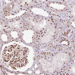 Nucleostemin Antibody in Immunohistochemistry (Paraffin) (IHC (P))