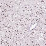 Nucleostemin Antibody in Immunohistochemistry (Paraffin) (IHC (P))