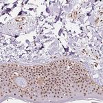 Nucleostemin Antibody in Immunohistochemistry (Paraffin) (IHC (P))