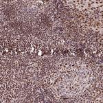 Nucleostemin Antibody in Immunohistochemistry (Paraffin) (IHC (P))