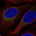 Glucagon Antibody in Immunocytochemistry (ICC/IF)