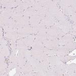 Glucagon Antibody in Immunohistochemistry (Paraffin) (IHC (P))