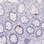 Glucagon Antibody in Immunohistochemistry (Paraffin) (IHC (P))