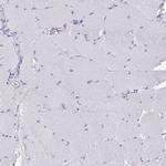 Glucagon Antibody in Immunohistochemistry (Paraffin) (IHC (P))