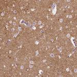 Neurocan Antibody in Immunohistochemistry (Paraffin) (IHC (P))