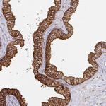 Calpastatin Antibody in Immunohistochemistry (Paraffin) (IHC (P))