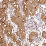 CNDP2 Antibody in Immunohistochemistry (Paraffin) (IHC (P))