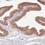 CNDP2 Antibody in Immunohistochemistry (Paraffin) (IHC (P))