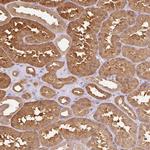 CNDP2 Antibody in Immunohistochemistry (Paraffin) (IHC (P))