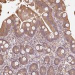 CNDP2 Antibody in Immunohistochemistry (Paraffin) (IHC (P))