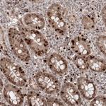 KIF20A Antibody in Immunohistochemistry (Paraffin) (IHC (P))