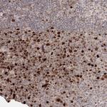 KIF20A Antibody in Immunohistochemistry (Paraffin) (IHC (P))