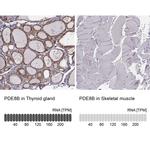 PDE8B Antibody