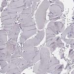 PDE8B Antibody in Immunohistochemistry (Paraffin) (IHC (P))