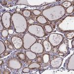 PDE8B Antibody in Immunohistochemistry (Paraffin) (IHC (P))