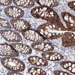 HMGCS1 Antibody in Immunohistochemistry (Paraffin) (IHC (P))