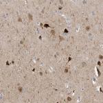 HMGCS1 Antibody in Immunohistochemistry (Paraffin) (IHC (P))