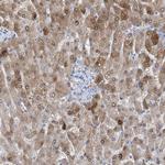 HMGCS1 Antibody in Immunohistochemistry (Paraffin) (IHC (P))