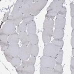 HMGCS1 Antibody in Immunohistochemistry (Paraffin) (IHC (P))