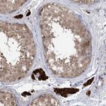 HMGCS1 Antibody in Immunohistochemistry (Paraffin) (IHC (P))