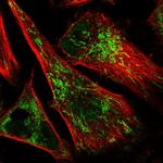 IMPA1 Antibody in Immunocytochemistry (ICC/IF)