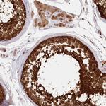 IMPA1 Antibody in Immunohistochemistry (Paraffin) (IHC (P))