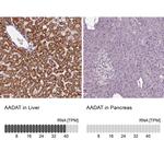 AADAT Antibody