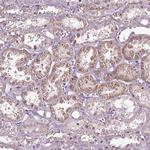 AADAT Antibody in Immunohistochemistry (Paraffin) (IHC (P))