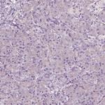 AADAT Antibody in Immunohistochemistry (Paraffin) (IHC (P))