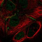 MPP7 Antibody in Immunocytochemistry (ICC/IF)